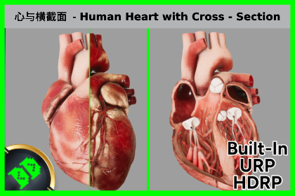 心与横截面 - Human Heart with Cross Section